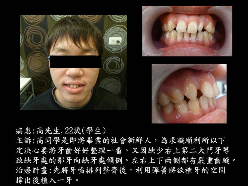 投影片2.JPG