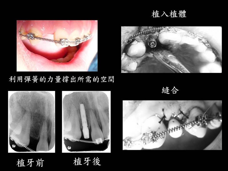 投影片3.JPG
